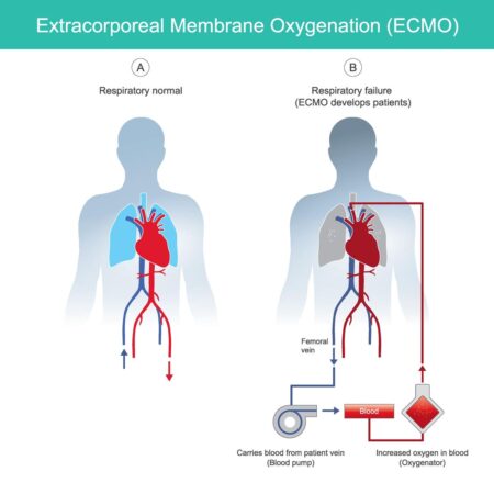 A Celebration Of Dr. Robert Bartlett, The ‘Father Of ECMO’