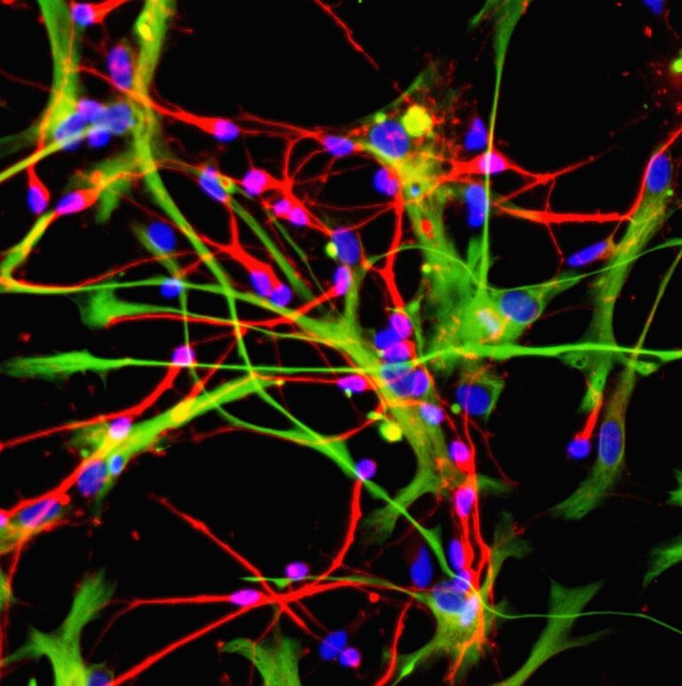 New Insight Into How The Brain Works