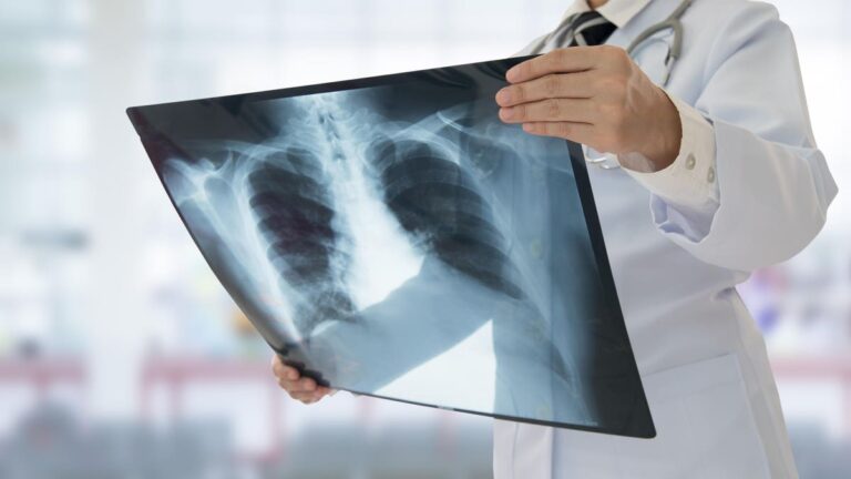Artificial Intelligence Is Rapidly Changing The World Of Medical Imaging