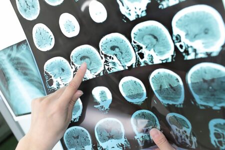 Re-Thinking The ‘When’ And ‘How’ Of Brain Death
