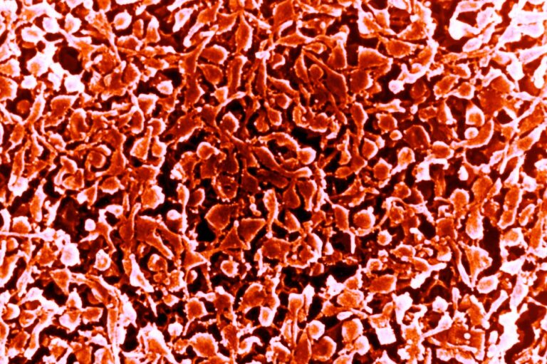 Mycoplasma Likely Main Culprit Of Outbreak Of Pediatric Cases Of Pneumonia Worldwide