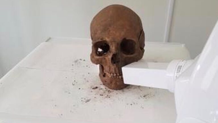 Vikings 1,000 Years Ago Had Surprisingly Advanced Dental Care