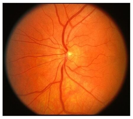 The Interconnected Body: How The Eyes Reveal Signs Of Cardiovascular Disease